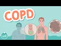 COPD - Chronic Obstructive Pulmonary Disease Emphysema vs Chronic Bronchitis