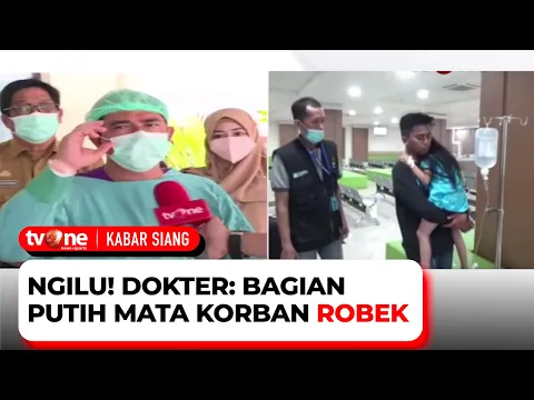 Jalani Operasi, Ini Penjelasan Dokter Terkait Luka yang Dialami Bocah Tumbal Pesugihan