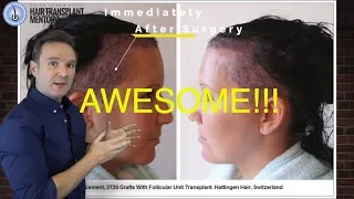 Hair Transplant Clinic- Hattingen Hair for EXCELLENT FUT & FUE
