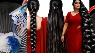 शैंपू से पहले यह दो चीज मिलाकर लगा लो बाल 20 गुना तेजी से बढ़ेंगे | Bal bhayankar lambe ghane Ho,