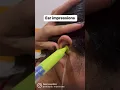 Download Lagu What do you think about ear impressions? Are they safe? #audiology #hear #hearingaids #hearingloss