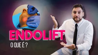 O que é o Endolift?
