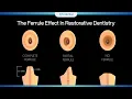 Download Lagu 🚫 The Ferrule Effect in Restorative Dentistry