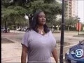 Biggest Natural Breasts in Texas - 36NNN Breast Reduction by Dr Franklin Rose