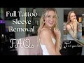 Full Tattoo Sleeve Removal FAQs 2 5 years update