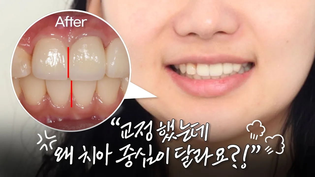 이거 아무리 봐도 교정이 잘못된 거 같은데요?? [안면비대칭교정]