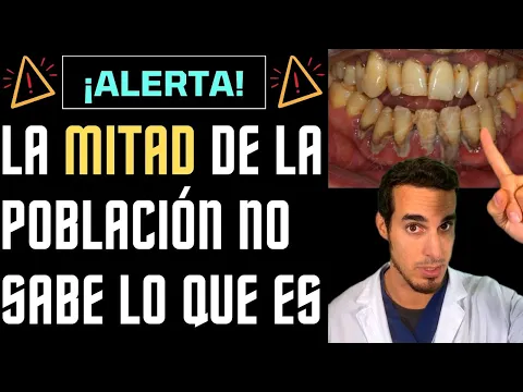 Download MP3 ⚠️¡ALERTA!⚠️ La MITAD de la POBLACIÓN no sabe lo que es la PERIODONTITIS