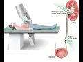 Renal endoscopy CPT code - simplify medical coding