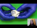 Sheep Eyeball Dissection