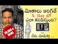 Osteoarthritis knee Xray changes Staging explained Telugu Dr Ramprasad Kancherla