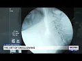 The art of swallowing