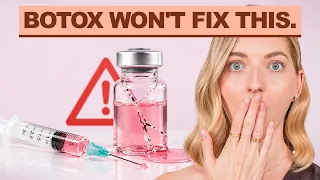 I’m Shocked Plastic Surgeons Hide This! How to Lift Your Lower Face Naturally