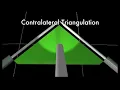Basics of Laparoscopic Suturing