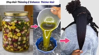 Say Bye to Hair Thinning / Stop Alopecia and Hair Thinning with this Powerful Treatment.