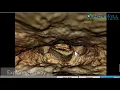 Airway Analysis