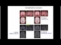 SPM12 Kyiv 2015 part 5 - segementation normalisation