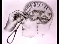 Download Lagu lobotomy sound effect