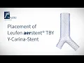 Placement of Leufen aerstent TBY