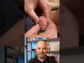 Download Lagu Doctor reacts to INSANE shooting pimple pop! #dermreacts #doctorreacts #pimplepop