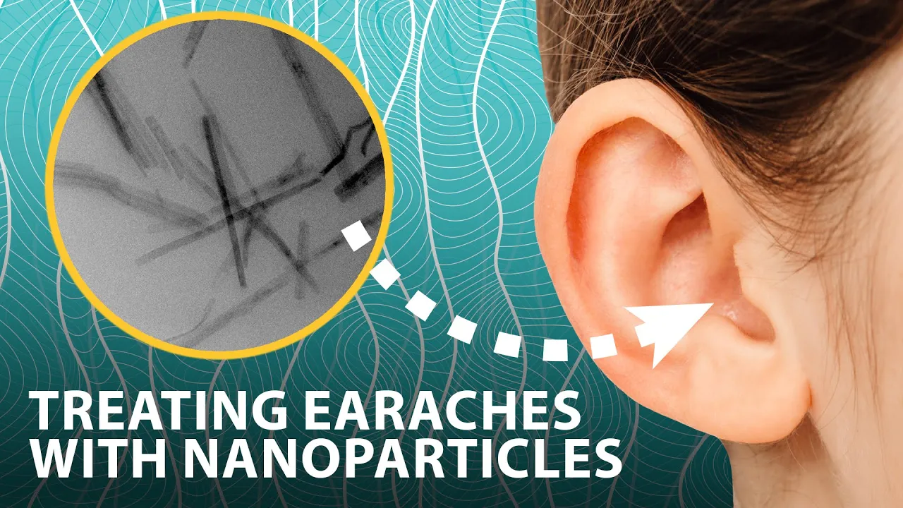 Treating earaches with nanoparticles that generate antiseptic on demand | Headline Science Treating earaches with nanoparticles that generate antiseptic on demand | Headline Science