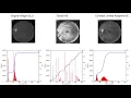 Python Histogram Equalization and Adaptive Histogram Equalization in Python