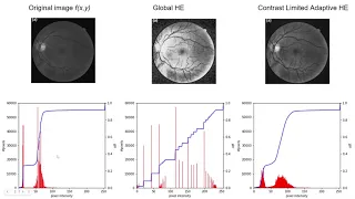 Python Histogram Equalization and Adaptive Histogram Equalization in Python