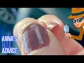 Why You Shouldn t Buff Nail Ridges Anna s Nail Advice