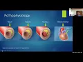 Transfusion-free Lecture Series From Keck Medicine of USC Fall 2021