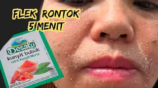 BUMBU AJAIB!! FLEK HITAMMU JADI PUTIH GLOW UP TANPA CREAM APOTIK!!