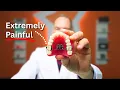 99 of Parents Choose Expanders To Fix A Child s Teeth and It s WRONG