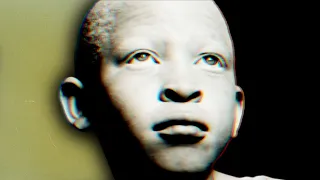 the chilling truth about albino hunters