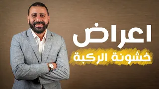 أهم اعراض خشونة الركبة   د محمود عبدالوهاب دندنها