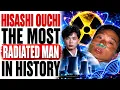 Hisashi Ouchi The Most Radiated Man in History Tokaimura Nuclear Accident Explained