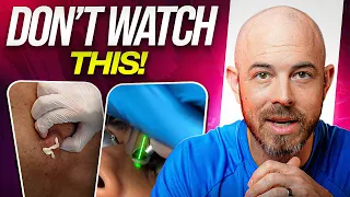 Stop Popping Pimples With Your Nails