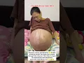 Download Lagu Tasbih song | Stomach Cancer grand mother#emotional#shortvideo#newtiktok#ytshorts#tiktokviral