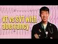 VT vs. SVT With Aberrancy Explained - High Yield \u0026 Made Easy!