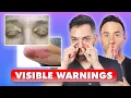 11 DANGEROUS Skin Signs You Should NEVER IGNORE Dermatologists Explain
