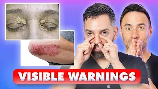 11 DANGEROUS Skin Signs You Should NEVER IGNORE Dermatologists Explain