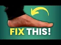 FLAT FEET Problems That Come WITH Them How to Fix NASM-CPT SFC