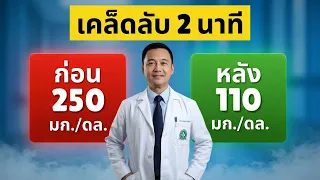 ทำไมแผลเบาหวานจึงรักษาได้ยากและอาจนำไปสู่การตัดขา