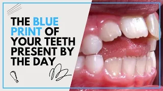 THE BLUE PRINT OF YOUR TEETH PRESENT BY THE DAY House of Dentistry Bangalore