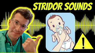 Download Doctor explains Stridor with real examples of sounds (plus causes, treatment and warning signs) MP3