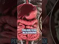 Download Lagu Apa itu Askariasis: Penyebab Tubuh Raya Penuh Cacing