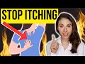 Download Lagu HOW TO STOP ITCHING ON THE BACK | Notalgia Paresthetica
