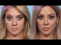Nose Job El Paso - Rhinoplasty Dr Agullo