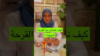 التعامل الصحيح مع قرحه عنق الرحم حتى لا تتحول إلى سرطان الدكتوره انعام سلهب 