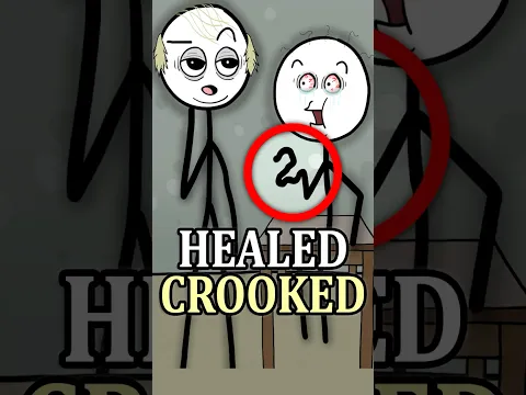 Broken Bones Could Leave You Deformed 🦴😮 #history #facts #medieval #shorts