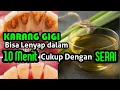 Download Lagu LUAR BIASA ! - Cara Merontokkan Karang Gigi Yang  Sudah Membandel Cukup Bermodal Serai.