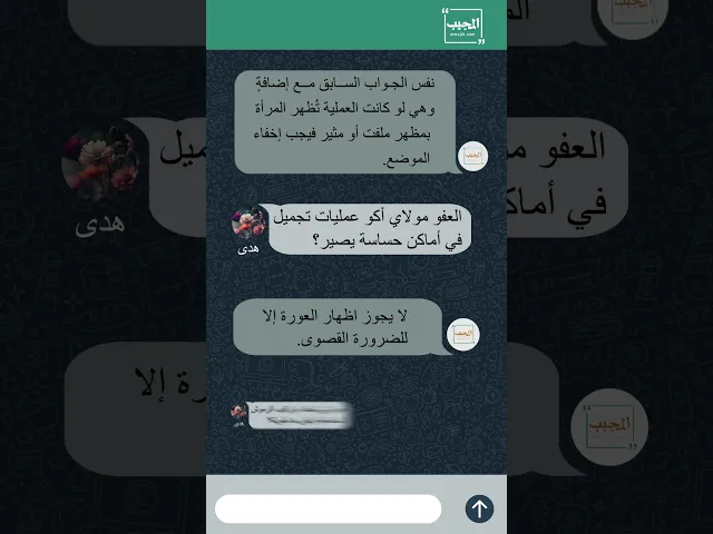 ⁣#هدى_تسأل عن حكم عمليات التجميل.