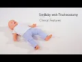SimBaby with Tracheostomy - Clinical Features